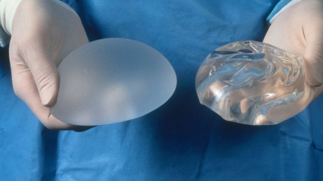 breast implant cancer